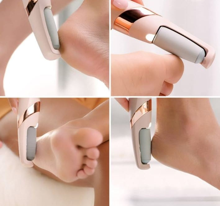 Rechargeable Electric Foot Callus Remover