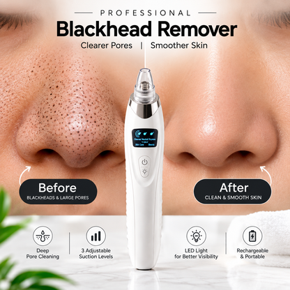 Black Head Remover